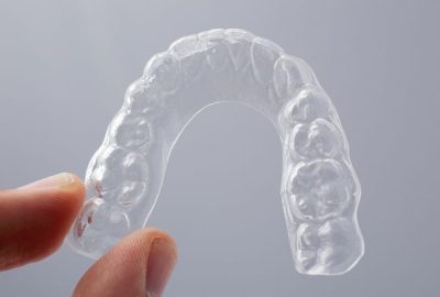 Hand holding a translucent upper essix retainer